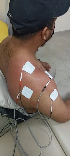 Atención de fisioterapia: Neuromodulación ecoguiada